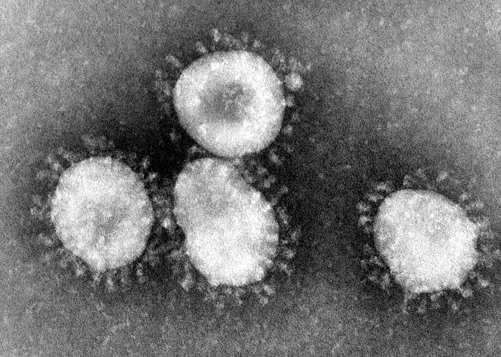 Typical coronavirus particles